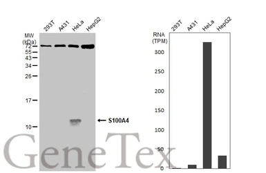 Anti-S100A4 antibody used in Western Blot (WB). GTX134743