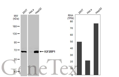 Anti-IGF2BP1 antibody used in Western Blot (WB). GTX134816