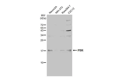 Anti-PBR antibody used in Western Blot (WB). GTX134851