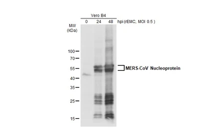 Anti-MERS-CoV Nucleoprotein antibody used in Western Blot (WB). GTX134868