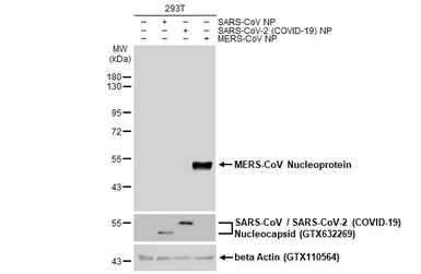 Anti-MERS-CoV Nucleoprotein antibody used in Western Blot (WB). GTX134868