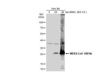 Anti-MERS-CoV ORF4b antibody used in Western Blot (WB). GTX134870