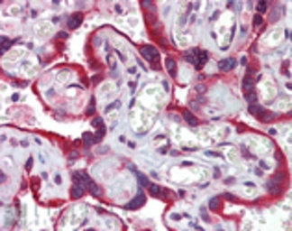 Anti-Calnexin antibody used in Immunohistochemistry (IHC). GTX13505