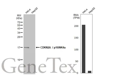 Anti-CDKN2A / p16INK4a antibody used in Western Blot (WB). GTX135119