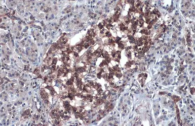 Anti-CDKN2A / p16INK4a antibody used in IHC (Paraffin sections) (IHC-P). GTX135119
