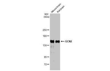 Anti-GCN2 antibody used in Western Blot (WB). GTX135252