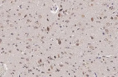 Anti-Rag A antibody used in IHC (Paraffin sections) (IHC-P). GTX135318