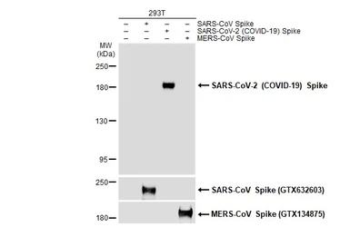 Anti-SARS-CoV-2 (COVID-19) Spike antibody used in Western Blot (WB). GTX135356