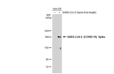 Anti-SARS-CoV-2 (COVID-19) Spike antibody used in Western Blot (WB). GTX135356