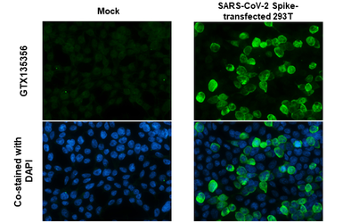 Anti-SARS-CoV-2 (COVID-19) Spike antibody used in Immunocytochemistry/ Immunofluorescence (ICC/IF). GTX135356