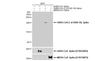 Anti-SARS-CoV-2 (COVID-19) Spike antibody used in Western Blot (WB). GTX135360
