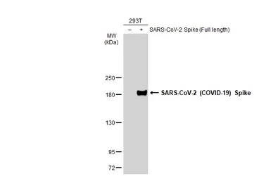 Anti-SARS-CoV-2 (COVID-19) Spike antibody used in Western Blot (WB). GTX135360
