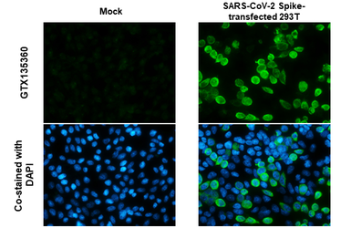 Anti-SARS-CoV-2 (COVID-19) Spike antibody used in Immunocytochemistry/ Immunofluorescence (ICC/IF). GTX135360