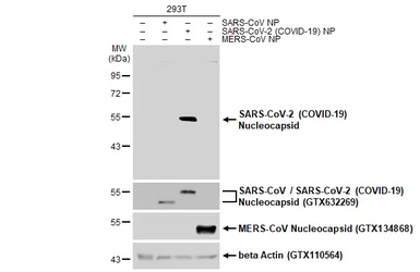 Anti-SARS-CoV-2 (COVID-19) Nucleocapsid antibody used in Western Blot (WB). GTX135361