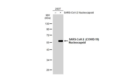 Anti-SARS-CoV-2 (COVID-19) Nucleocapsid antibody used in Western Blot (WB). GTX135361