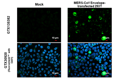 Anti-MERS-CoV Envelope protein antibody used in Immunocytochemistry/ Immunofluorescence (ICC/IF). GTX135382