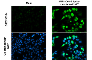 Anti-SARS-CoV-2 (COVID-19) Spike S1 antibody used in Immunocytochemistry/ Immunofluorescence (ICC/IF). GTX135384