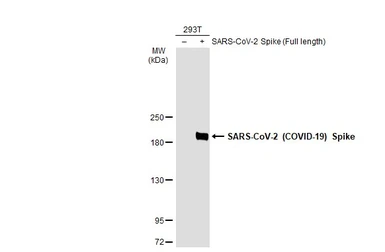 Anti-SARS-CoV-2 (COVID-19) Spike S1 antibody used in Western Blot (WB). GTX135384