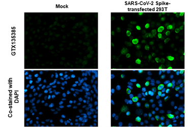 Anti-SARS-CoV-2 (COVID-19) Spike RBD antibody used in Immunocytochemistry/ Immunofluorescence (ICC/IF). GTX135385