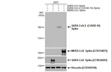 Anti-SARS-CoV-2 (COVID-19) Spike RBD antibody used in Western Blot (WB). GTX135385