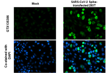 Anti-SARS-CoV-2 (COVID-19) Spike S2 / S2' antibody used in Immunocytochemistry/ Immunofluorescence (ICC/IF). GTX135386
