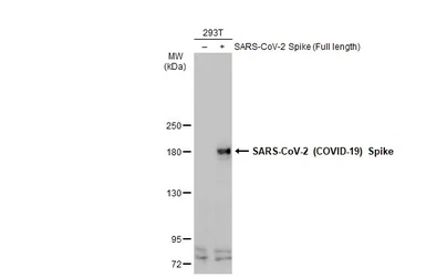 Anti-SARS-CoV-2 (COVID-19) Spike S2 / S2' antibody used in Western Blot (WB). GTX135386