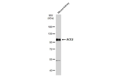 Anti-ACE2 antibody used in Western Blot (WB). GTX135404