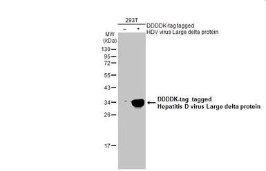 Anti-Hepatitis D virus Large delta protein antibody used in Western Blot (WB). GTX135574