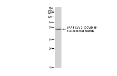 SARS-CoV-2 (COVID-19) Nucleocapsid protein, His tag. GTX135592-pro