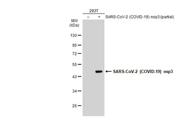 Anti-SARS-CoV-2 (COVID-19) nsp3 antibody used in Western Blot (WB). GTX135614
