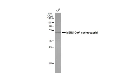 MERS-CoV Nucleocapsid protein, DDDDK tag. GTX135653-pro