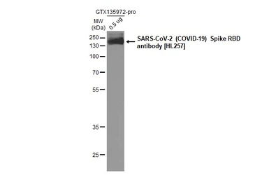 SARS-CoV-2 (COVID-19) Spike (ECD) protein, His tag (active). GTX135972-pro
