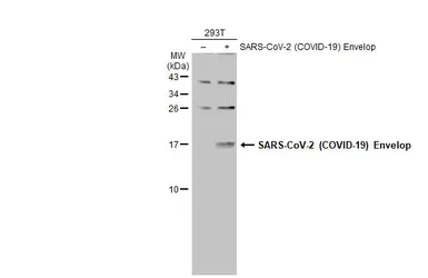 Anti-SARS-CoV-2 (COVID-19) Envelope antibody used in Western Blot (WB). GTX136046