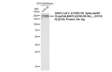 SARS-CoV-2 (COVID-19) Spike (ECD) Protein, B.1.1.7 / Alpha variant, His tag (active). GTX136059-pro