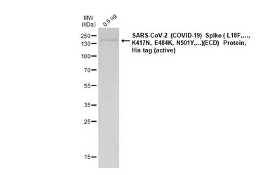 SARS-CoV-2 (COVID-19) Spike (ECD) Protein, B.1.351 / Beta variant, His tag (active). GTX136061-pro