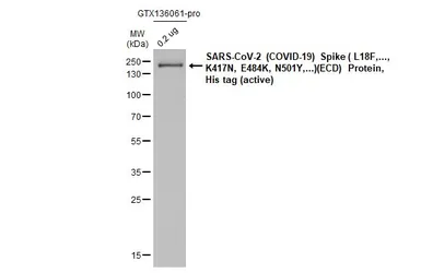 SARS-CoV-2 (COVID-19) Spike (ECD) Protein, B.1.351 / Beta variant, His tag (active). GTX136061-pro