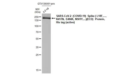 SARS-CoV-2 (COVID-19) Spike (ECD) Protein, B.1.351 / Beta variant, His tag (active). GTX136061-pro