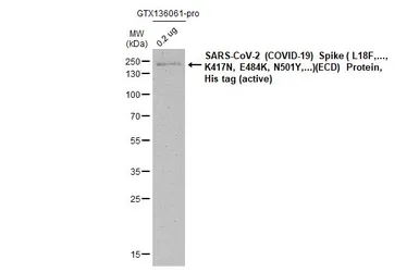 SARS-CoV-2 (COVID-19) Spike (ECD) Protein, B.1.351 / Beta variant, His tag (active). GTX136061-pro