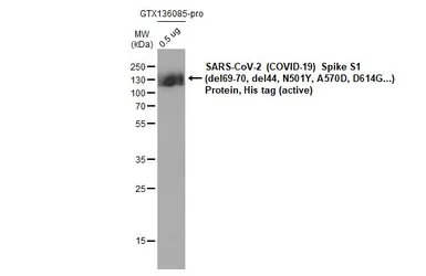 SARS-CoV-2 (COVID-19) Spike S1 Protein, B.1.1.7 / Alpha variant, His tag (active). GTX136085-pro
