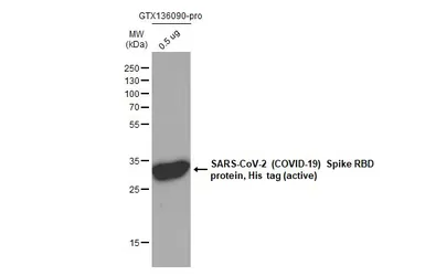 SARS-CoV-2 (COVID-19) Spike RBD protein, His tag (active). GTX136090-pro