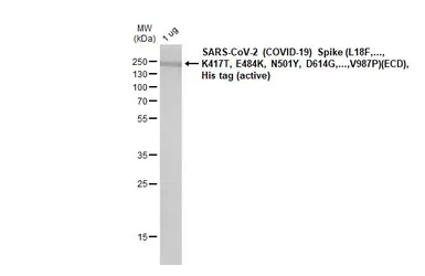 SARS-CoV-2 (COVID-19) Spike (ECD) Protein, P.1 / Gamma variant, His tag (active). GTX136091-pro