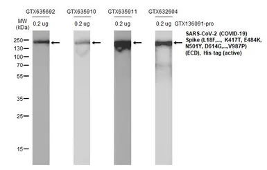 SARS-CoV-2 (COVID-19) Spike (ECD) Protein, P.1 / Gamma variant, His tag (active). GTX136091-pro