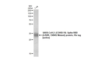 SARS-CoV-2 (COVID-19) Spike RBD Protein, B.1.617.1 / Kappa variant, His tag (active). GTX136299-pro