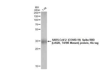 SARS-CoV-2 (COVID-19) Spike RBD Protein, B.1.617.2 / Delta variant, His tag (active). GTX136332-pro