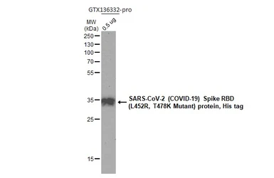 SARS-CoV-2 (COVID-19) Spike RBD Protein, B.1.617.2 / Delta variant, His tag (active). GTX136332-pro