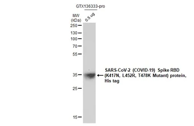 SARS-CoV-2 (COVID-19) Spike RBD Protein, AY.1 / Delta plus variant, His tag (active). GTX136333-pro