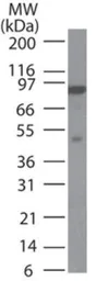 Anti-MLH1 antibody [164C819] used in Western Blot (WB). GTX13659