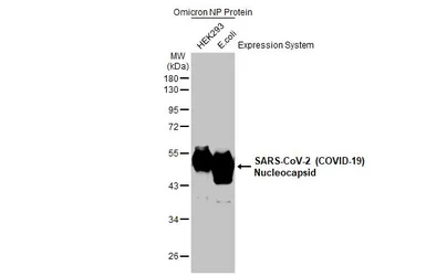 SARS-CoV-2 (COVID-19) Nucleocapsid protein, Omicron / BA.1 variant, His tag. GTX136779-pro