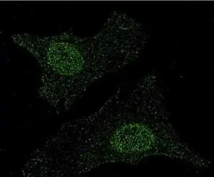 Anti-MITF antibody [21D1418] used in Immunocytochemistry/ Immunofluorescence (ICC/IF). GTX13703