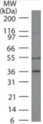 Anti-MITF antibody [21D1418] used in Western Blot (WB). GTX13703